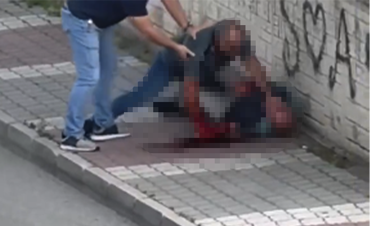 Sokak Ortasında Kanlı Kardeş Kavgası